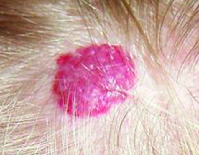 hemangioma on dog skin