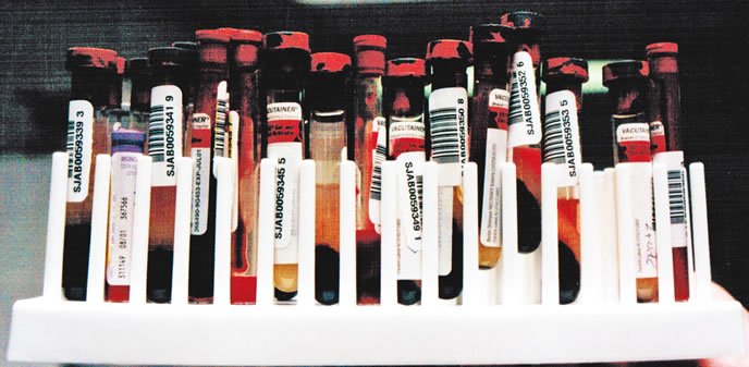 dog blood samples