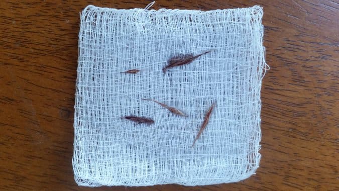 Foxtail removed from dog's nose