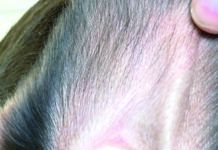 Cleaning dogs ears can help prevent ear infections later on down the line.