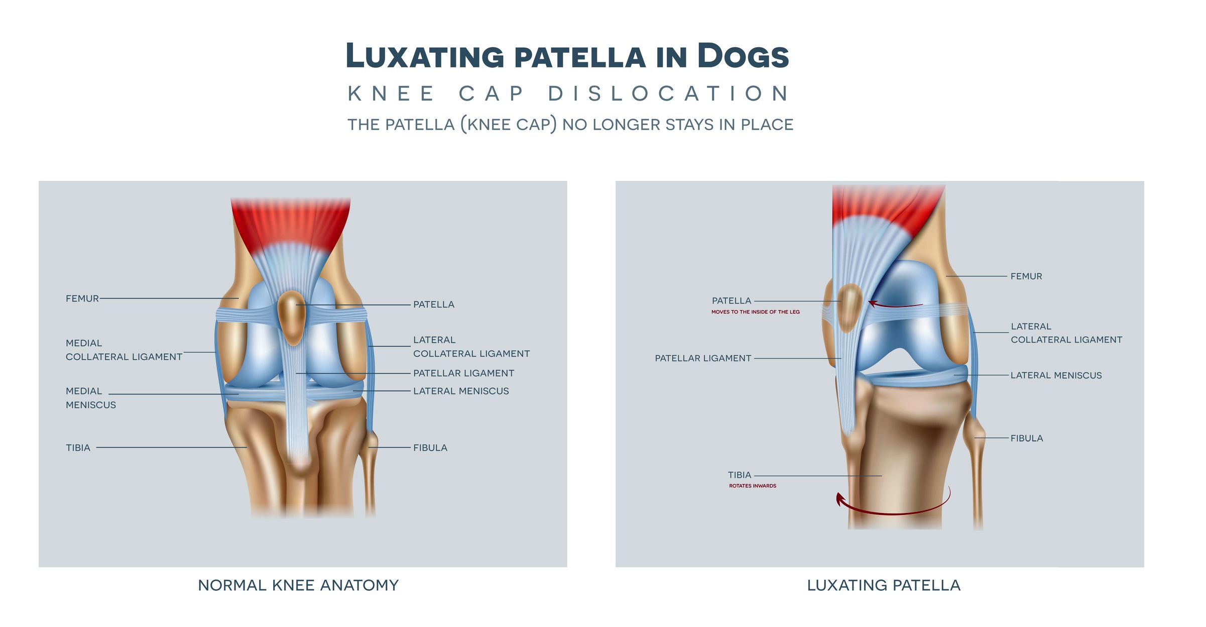 Patella misaligned discount